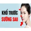 Tướng số người khổ trước sướng sau tiết lộ vận mệnh