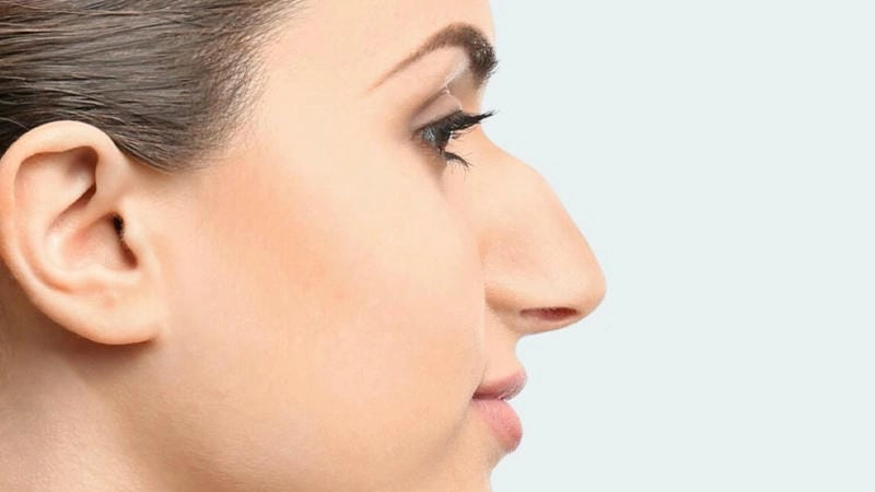 Khám phá mũi gồ phản ánh tính cách và vận mệnh thế nào