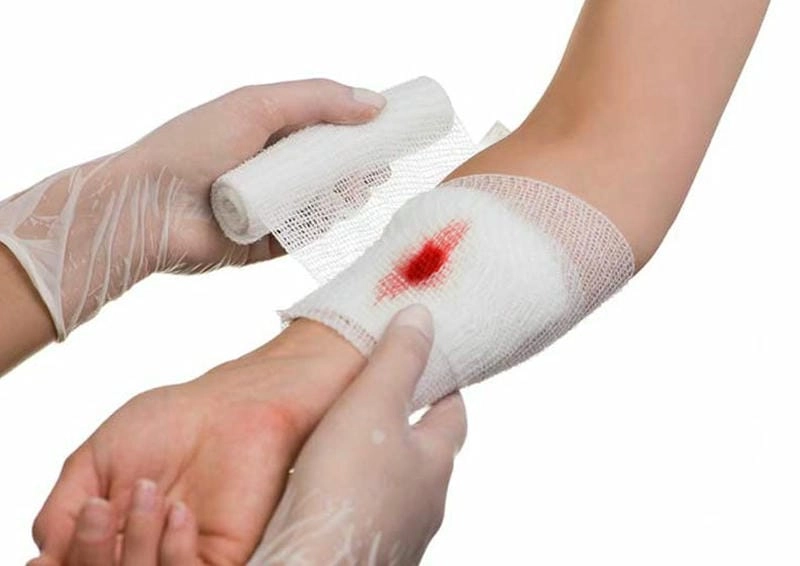Mùng 1 bị chảy máu có sao không cần chú ý sức khỏe kỹ