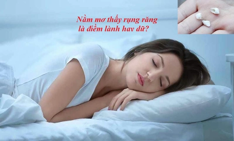 Khám phá giải mã chi tiết nằm mơ gãy răng báo hiệu điều gì