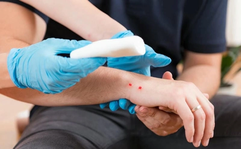 Khám phá giải mã chi tiết giấc mơ nằm mơ rắn cắn chảy máu