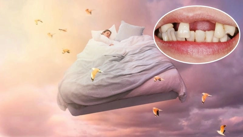 Khám phá giải mã chi tiết giấc mơ rụng 4 cái răng cực thú vị