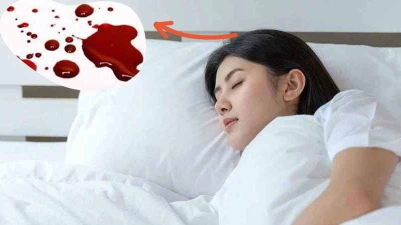 Khám phá ý nghĩa mơ thấy máu là điềm gì để hiểu rõ hơn vận mệnh
