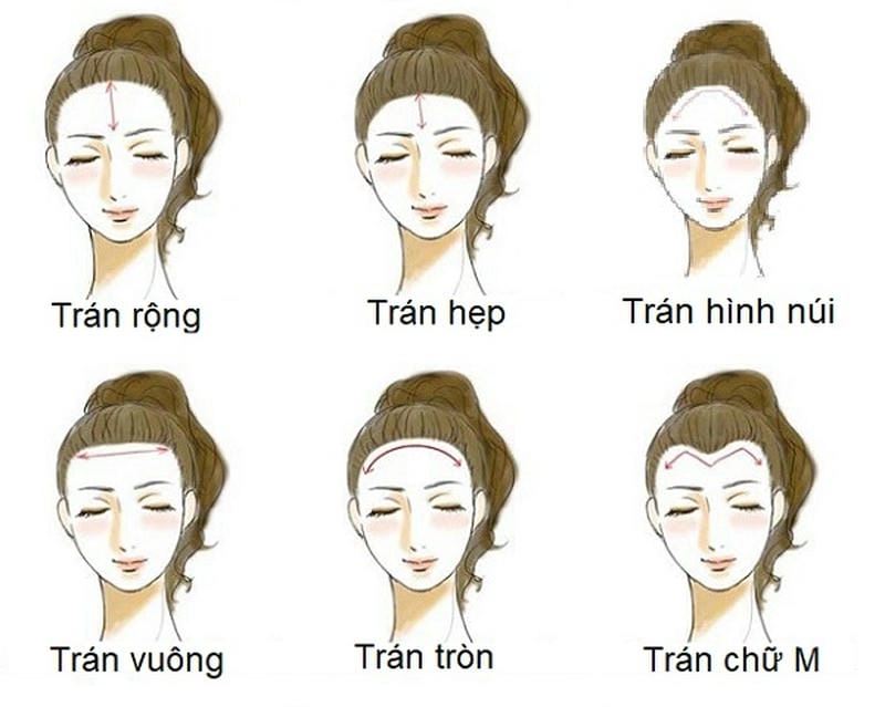 Khám phá ý nghĩa các dạng trán phổ biến trong nhân tướng học