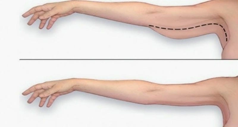 Khám phá ý nghĩa tướng số của bắp tay
