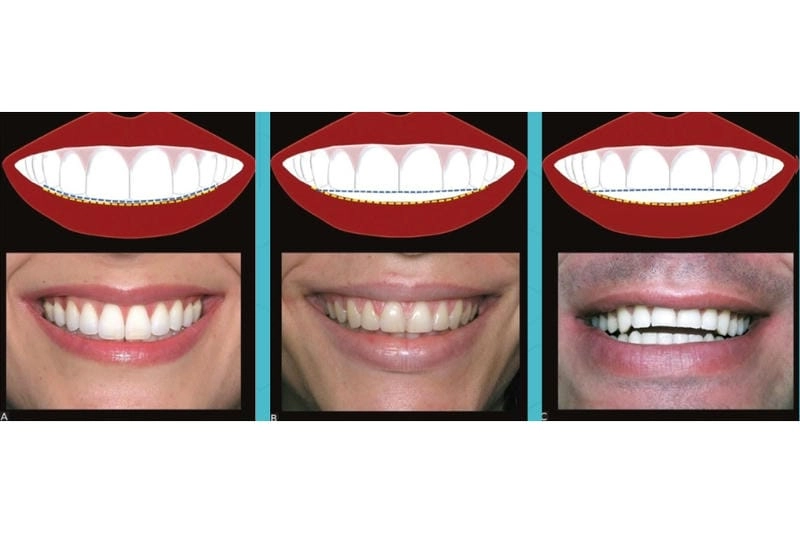 Khám phá ý nghĩa của nụ cười trong nhân tướng học