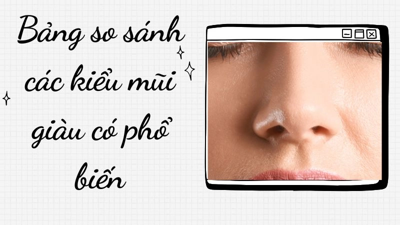 Bảng so sánh các kiểu mũi giàu có phổ biến
