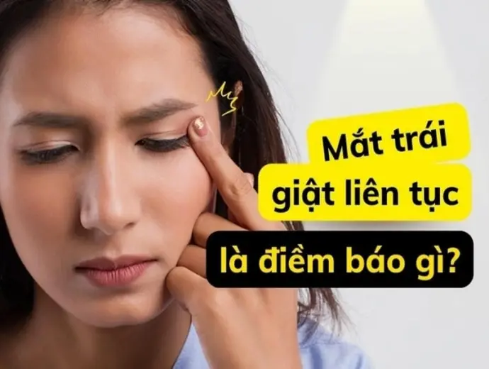 Giải mã mắt giật bên trái có điềm gì chính xác nhất?