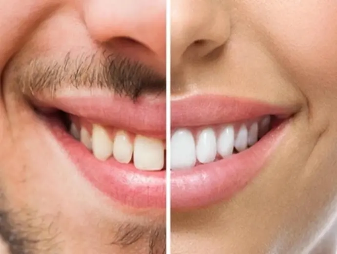 Luận giải nhân tướng học môi để hiểu rõ vận mệnh bản thân