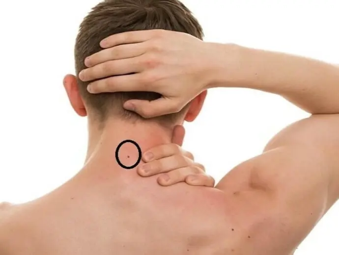 Tướng số nốt ruồi sau gáy và ý nghĩa phong thủy cuộc đời