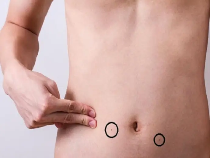 Xem tướng qua nốt ruồi ở bụng luận đoán vận mệnh con người