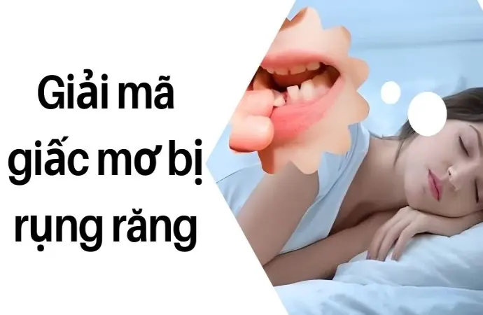 Giải mã giấc mơ bị rụng răng hé lộ điềm báo lạnh gáy