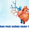 Block Nhánh Phải Không Hoàn Toàn: Nguyên Nhân, Triệu Chứng và Cách Xử Lý