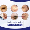 Giải mã nốt ruồi trên mặt đàn ông: Xem tướng vận mệnh, tính cách chi tiết