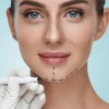 Trượt cằm là gì? Những điều cần biết về kỹ thuật và quy trình