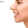 Tướng Phụ Nữ Răng Hô: Phân Tích Vận Mệnh, Tính Cách Và Cách Cải Thiện