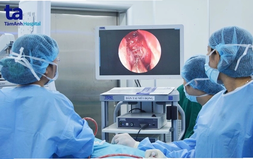Bác sĩ đang tiến hành nội soi mũi xoang để chẩn đoán và điều trị