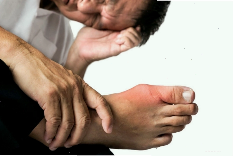 Bệnh gout có thể gây ra nhiều biến chứng nguy hiểm cho người bệnh