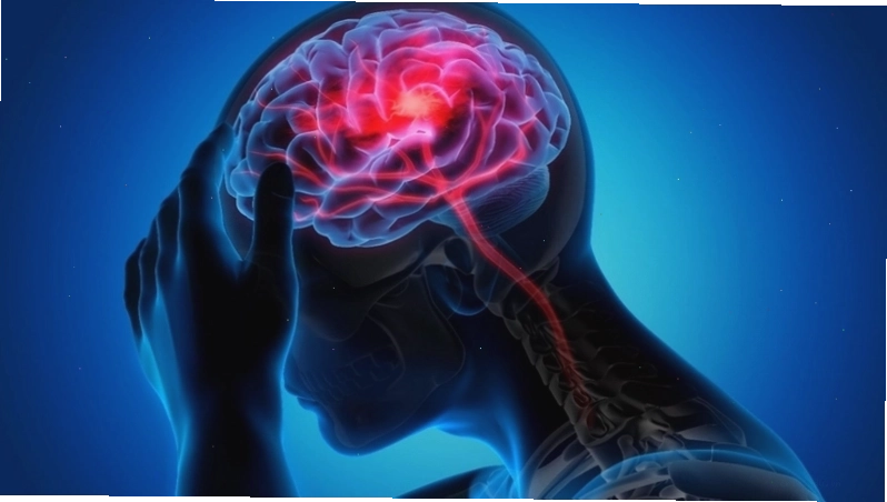 Biểu hiện của đột quỵ cần đi khám ngay