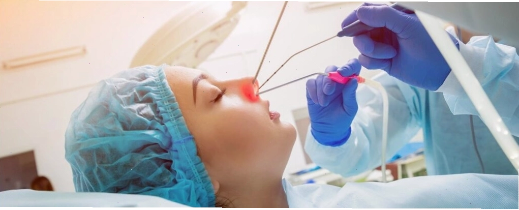 Chỉnh sửa lỗ mũi hở bằng phương pháp thẩm mỹ nâng mũi tại Thanh Hằng Beauty Medi