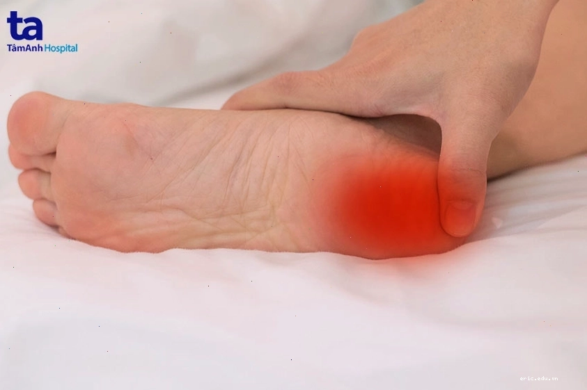Cơn đau nhức ở bàn chân, triệu chứng của viêm khớp phản ứng