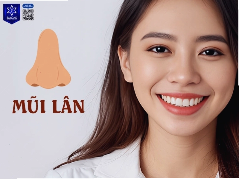 Đặc điểm mũi sư tử (mũi lân) và khả năng lãnh đạo bẩm sinh