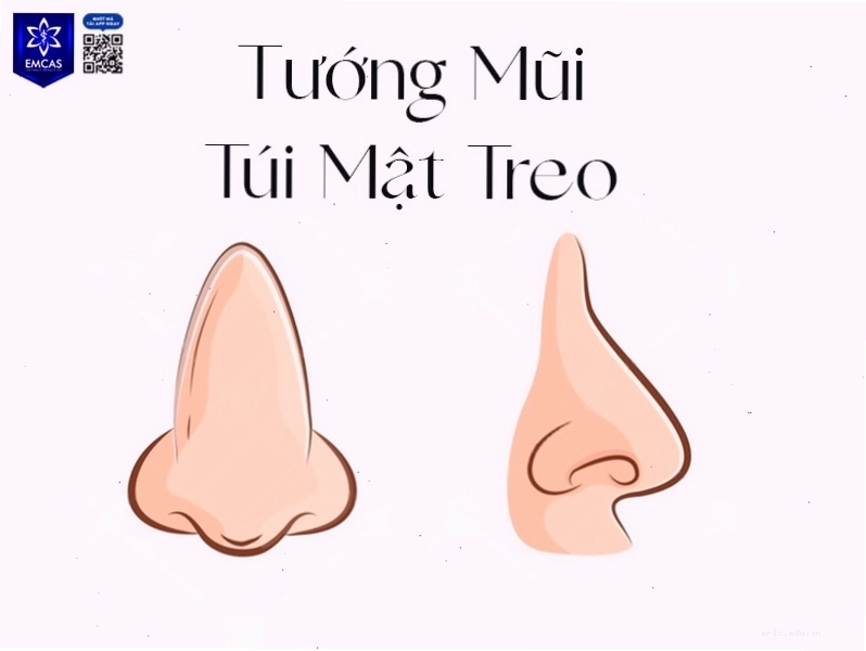 Đặc điểm mũi túi mật trong nhân tướng học và ý nghĩa tài lộc