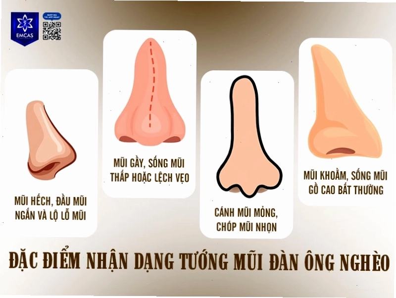 Đặc điểm nhận dạng tướng mũi đàn ông nghèo khó