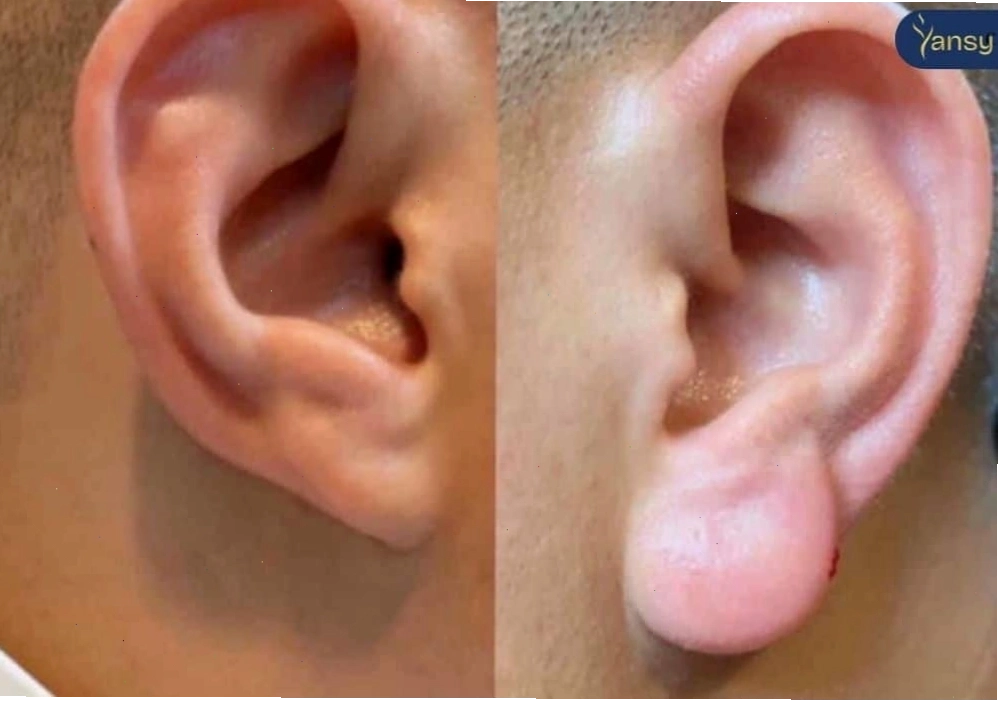 Dáng tai tài lộc cho đàn ông thể hiện sự phú quý và an nhàn