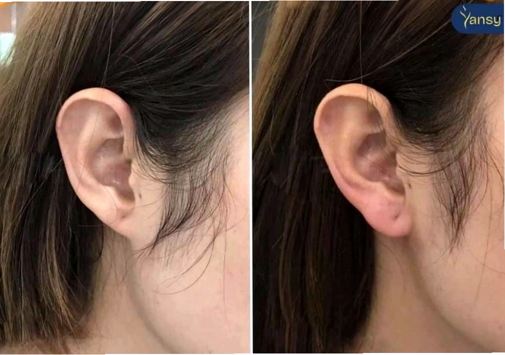 Dáng tai tài lộc cho phụ nữ