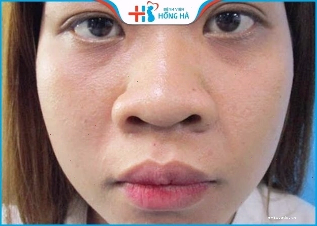 Đánh giá tướng mũi đẹp theo nhân tướng học