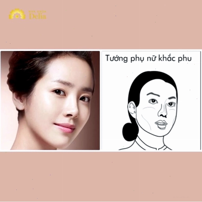 Gò má cao và ý nghĩa lãnh đạo