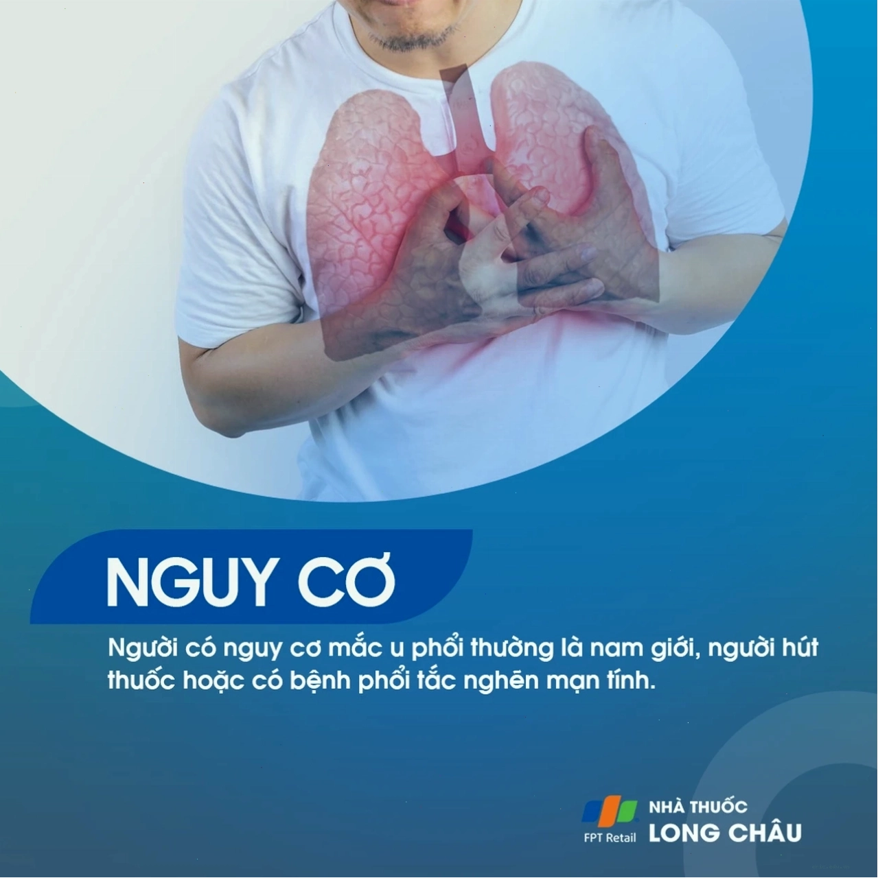 Hình ảnh chụp CT scan phổi