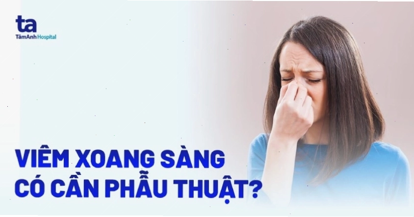 Hình ảnh giải phẫu cho thấy vị trí của các xoang sàng trong cấu trúc mặt