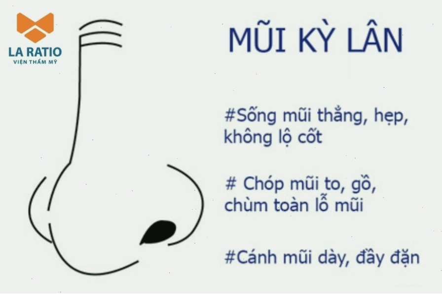 Hình ảnh minh họa đặc điểm tướng mũi lân với đầu mũi to và cánh mũi bè