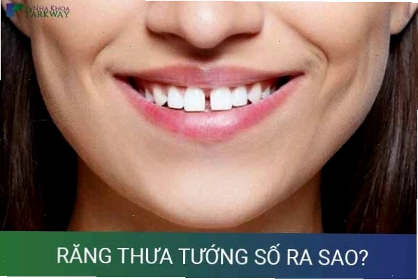 Hình ảnh minh họa hai răng cửa hàm trên mọc thưa nhau