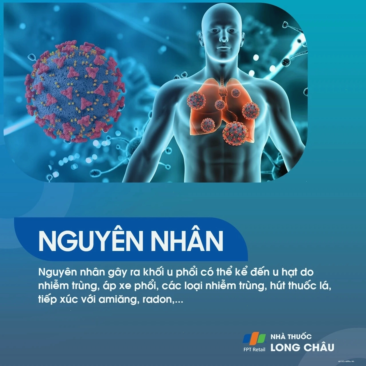 Hình ảnh mô tả ung thư phổi không tế bào nhỏ