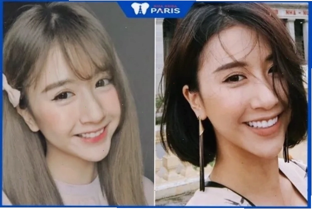 Hot girl Quỳnh Anh Shyn sở hữu chiếc cằm nhọn vừa phải, với khuôn mặt dễ thương, thu hút