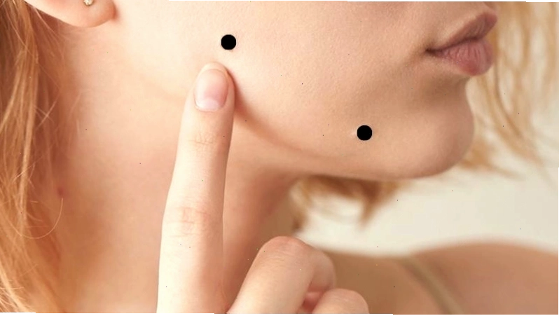 Hướng dẫn cách tẩy nốt ruồi hiệu quả và an toàn tại nhà