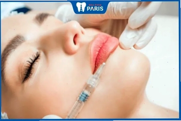 Kỹ thuật tiêm filler giúp làm đầy và tăng kích thước môi một cách hiệu quả và an toàn