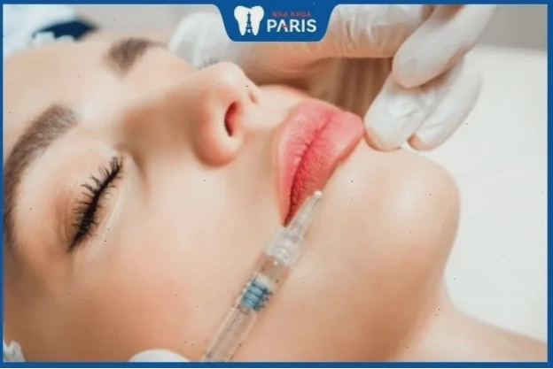 Kỹ thuật tiêm filler làm đầy môi