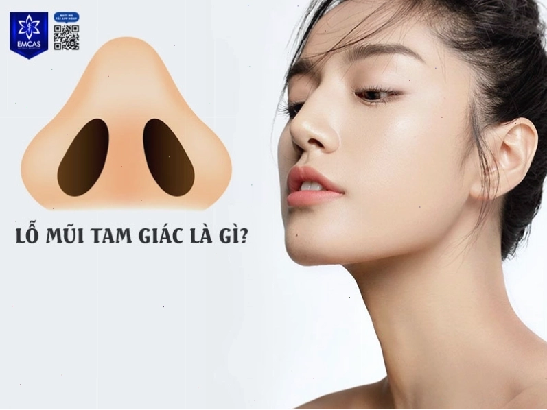 Lỗ mũi hếch hay lỗ mũi hứng hạt mưa trong nhân tướng học