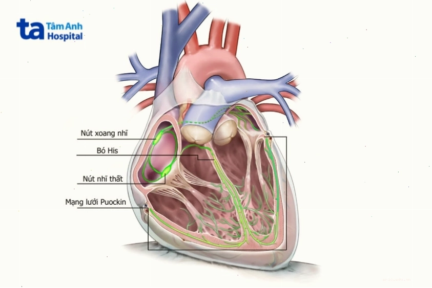 Minh họa hệ thống dẫn truyền của tim, bao gồm bó His và các nhánh