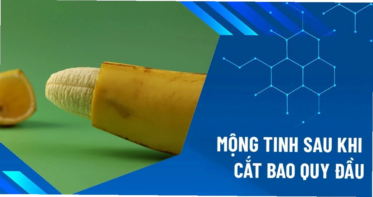 Mộng tinh sau khi cắt bao quy đầu