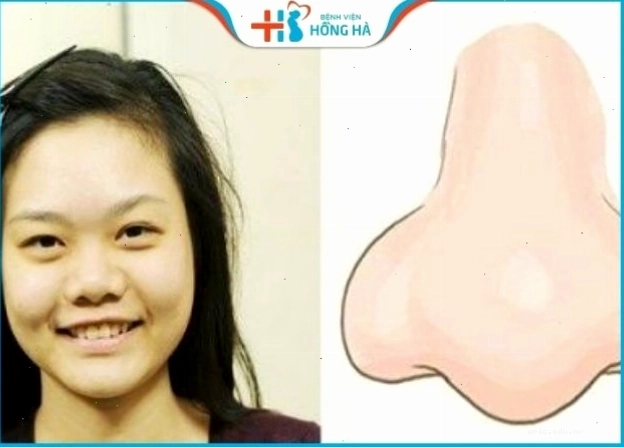Mũi củ tỏi tròn đầy cho cuộc sống ấm no