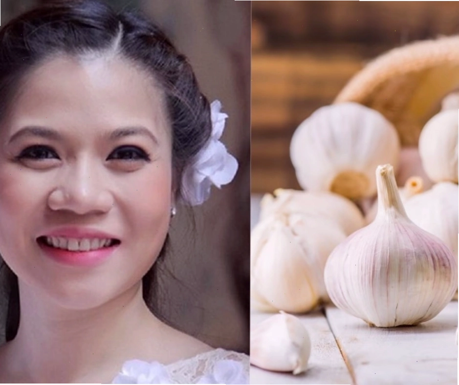 Mũi củ tỏi với đầu mũi to tròn và đầy đặn