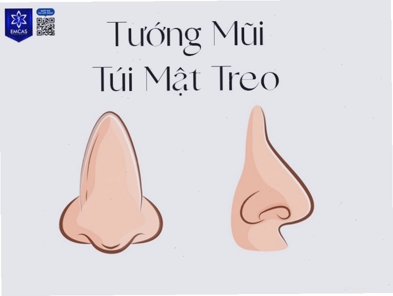 Mũi túi mật đầu mũi tròn thể hiện tài vận tốt