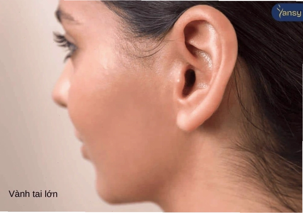 Người có vành tai lớn thường được coi là thông minh và rộng lượng