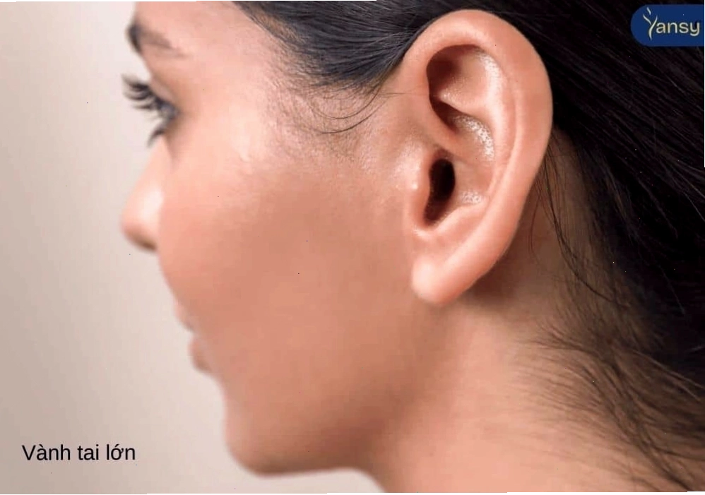 Người có vành tai lớn thường thông minh và rộng lượng