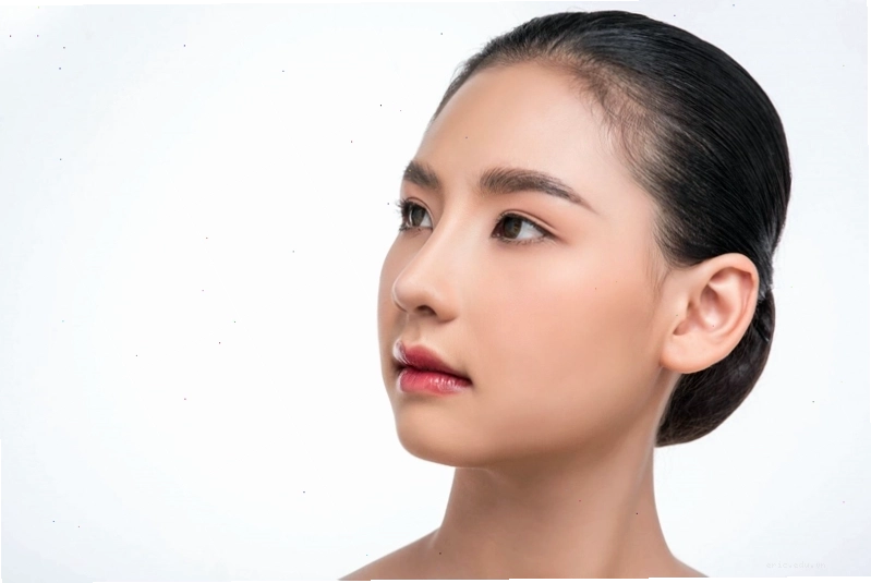Phẫu thuật trượt cằm để cải thiện dáng cằm ngắn làm mặt mất cân đối